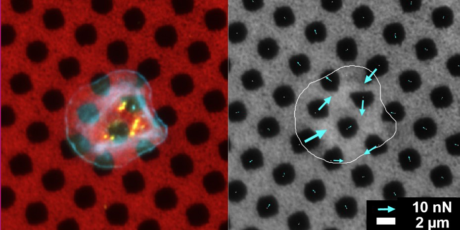 Split-screen display how much single platelets deform microscopic dot patterns, indicating platelet strength. The forces of the platelet are shown with the blue arrows on the right.